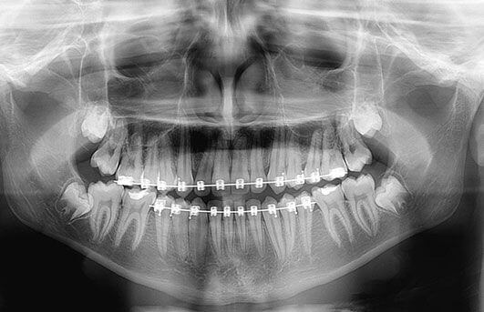 Radiografia Panorâmica